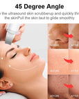 Ultrasonic Skin Scrubber Vibration Face