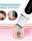 Ultrasonic Skin Scrubber Peeling Blackhead Remover